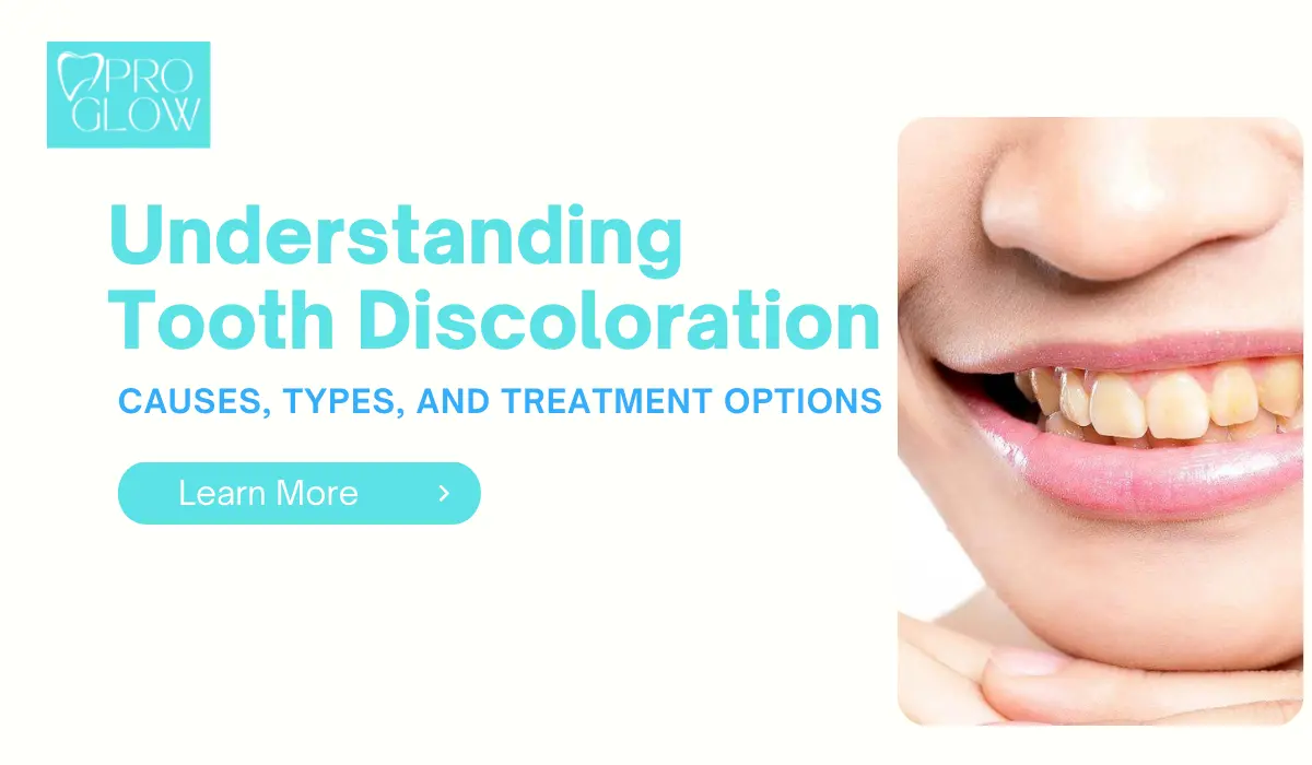 Understanding Tooth Discoloration: Causes, Types, and Treatment Options