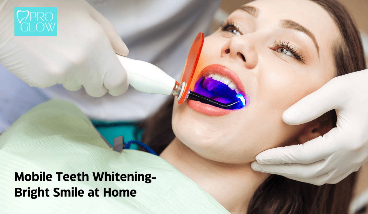 Mobile Teeth Whitening: Bringing the Bright Smile to Your Doorstep